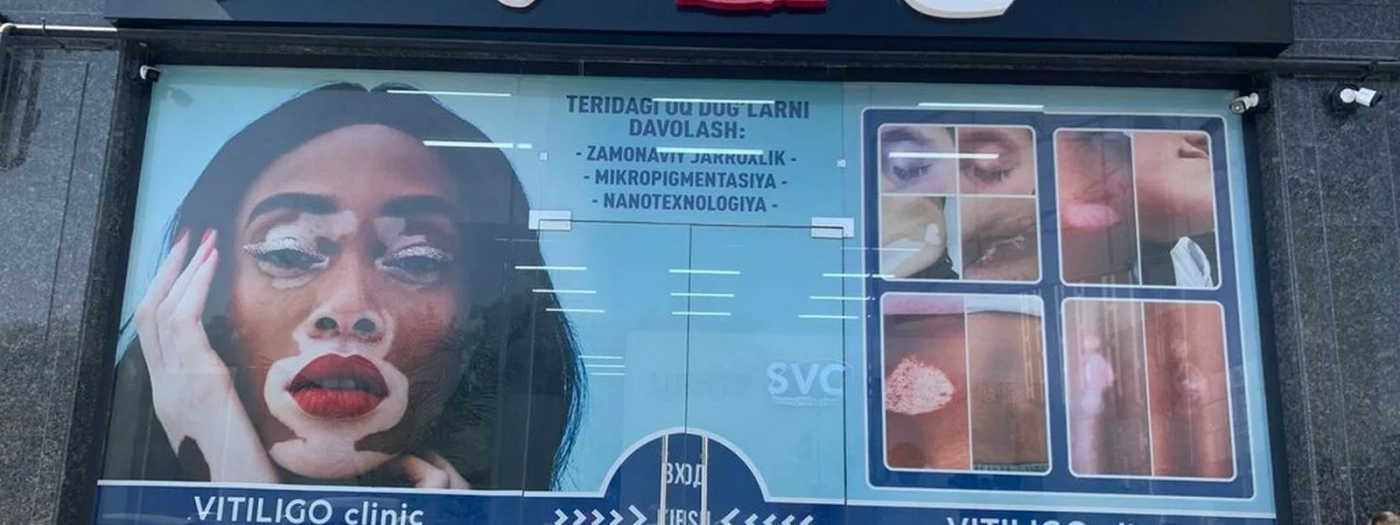 Saatov Vitiligo Clinic